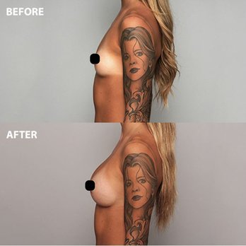 David Cho, MD - Breast Augmentation - Dr. David Cho - Cosmetic Surgeons Near Me - Honolulu, Hawaii David Cho, MD - Breast Augmentation - Dr. David Cho - Cosmetic Surgeons Near Me - Honolulu, Hawaii