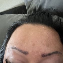 Athena Beauty Bar - 5 days after