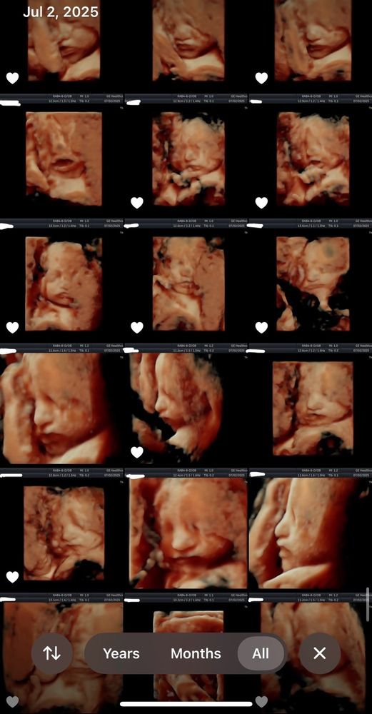 Prenatal Universe