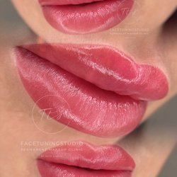 Facetuningstudio - Lip blushing