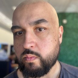 Me, after I got my head shaved, but not by a jumbo jet. Me, after I got my head shaved, but not by a jumbo jet.