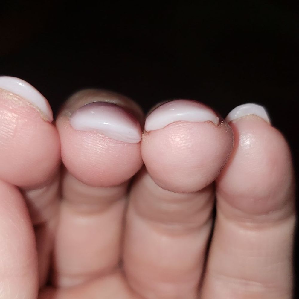 Fancy Nails - More powder under nail, thick thick - Nail Salons Near Me - Seguin, Texas Fancy Nails - More powder under nail, thick thick - Nail Salons Near Me - Seguin, Texas