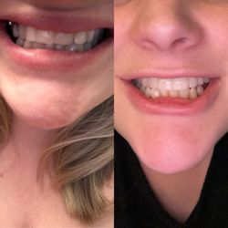 Joel Berger, DDS  MD - Post surgery