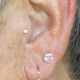 Tragus piercing (jewelry replacement) Tragus piercing (jewelry replacement)