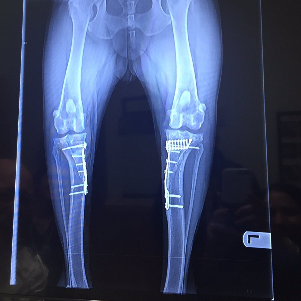 My pups x rays of both knee surgeries done here.