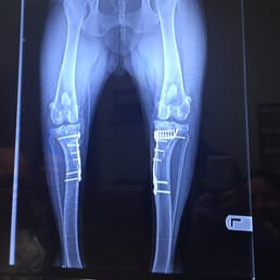 My pups x rays of both knee surgeries done here. My pups x rays of both knee surgeries done here.