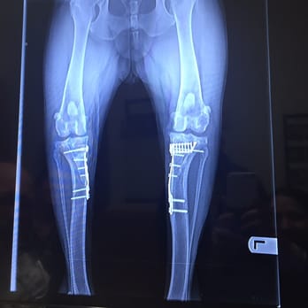 Meadowlands Veterinary Center - My pups x rays of both knee surgeries done here. - Veterinarians Near Me - Willoughby, Ohio Meadowlands Veterinary Center - My pups x rays of both knee surgeries done here. - Veterinarians Near Me - Willoughby, Ohio