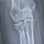 Romano Orthopaedic Center