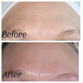 Beautiful Lotus - Results after the Anti Aging Firming Peptide Facial! Satisfied Customer! - Skin Care Near Me - Summerville, South Carolina Beautiful Lotus - Results after the Anti Aging Firming Peptide Facial! Satisfied Customer! - Skin Care Near Me - Summerville, South Carolina