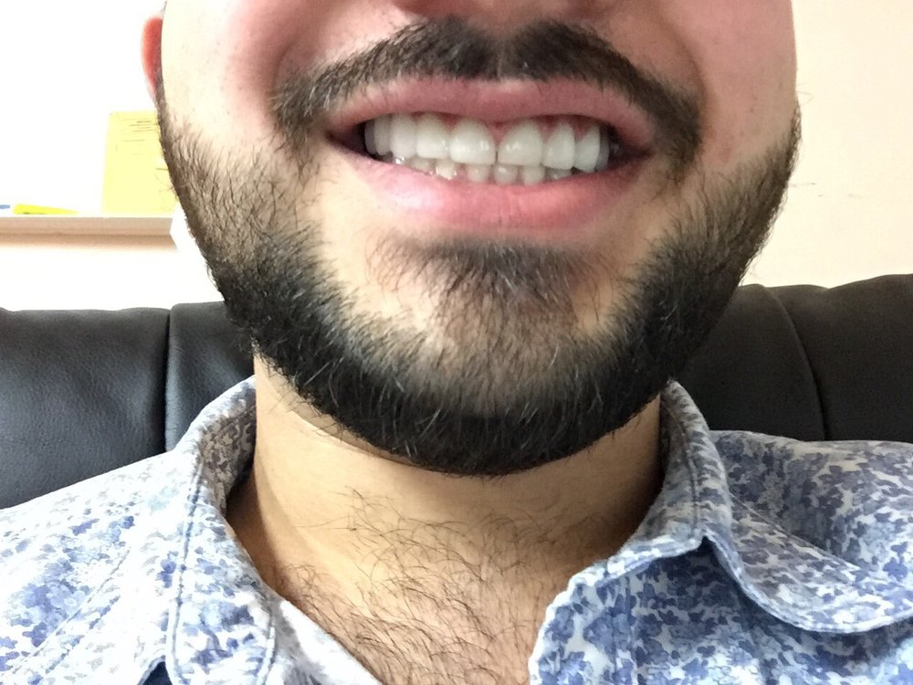 Suren Chtchyan, DDS, MD