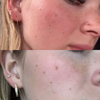 Skin by Shelby Aesthetics - Estheticians Near Me - Phoenix, Arizona