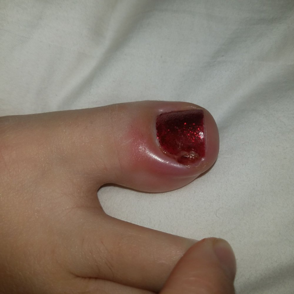 Posh Nails - PLEASE DONT GO TO THIS SALON! I AM NOW TAKING ANTIBIOTICS FOR AN INFECTION! SO PAINFUL! GO SOMEWHERE ELSE!!!! - Nail Salons Near Me - Palmdale, California