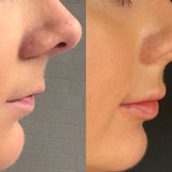 Christopher C Chang, M.D - Congressional Plastic Surgery - Before-- after - Cosmetic Surgeons Near Me - Chevy Chase, Maryland Christopher C Chang, M.D - Congressional Plastic Surgery - Before-- after - Cosmetic Surgeons Near Me - Chevy Chase, Maryland