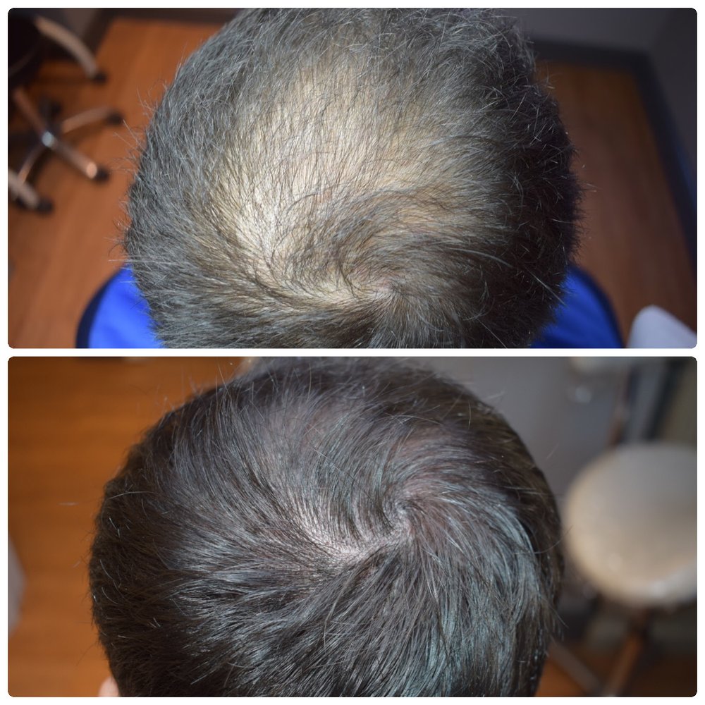 SCALP SOLUTIONS BY FLIGER 16 Alma Vale Rd, Bristol, United Kingdom