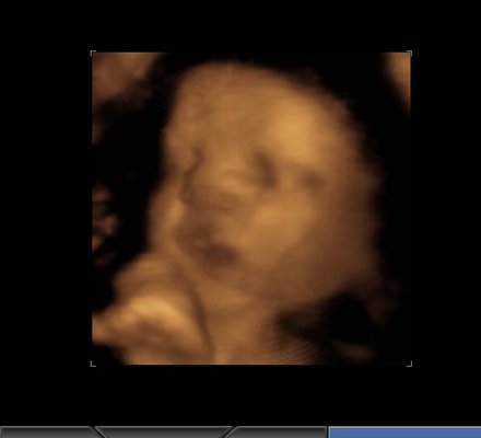 PEEK A BOO BABY 3D 4D ULTRASOUND - Updated April 2026 - 16 Photos & 10 ...