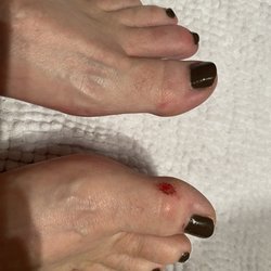 Both big toes were rubbed raw by the woman who did my pedicure!