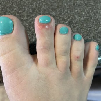 Bombshell Nail & Spa - The red marks on my feet were from the nail tech. My second toe is swollen and irritated. - Nail Salons Near Me - Las Vegas, Nevada