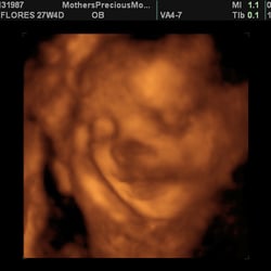 Magical 4D Images - My BABY GIRL