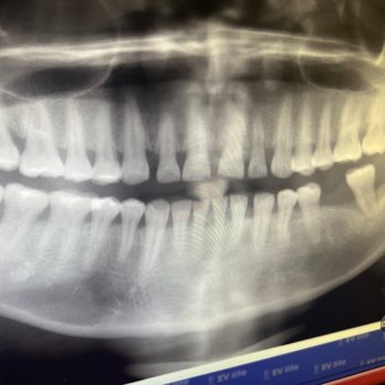 Cal Dental - Cosmetic Dentists Near Me - Van Nuys, California