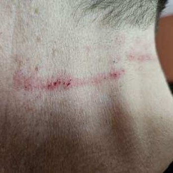 Great Clips - clipper abrasions - Hair Salons Near Me - Novi, Michigan Great Clips - clipper abrasions - Hair Salons Near Me - Novi, Michigan