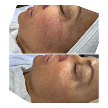 RNLosangeles - Skin Care Near Me - Studio City, California RNLosangeles - Skin Care Near Me - Studio City, California
