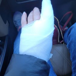 MinuteClinic at CVS - Bandaged hand