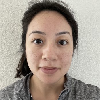 LaserAway - June 16th 2022, Before C + B (Clear and Brilliant) and IPL laser facial sessions - Laser Hair Removal Near Me - San Jose, California
