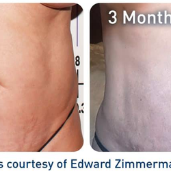 Enlighten Skin & Body Medspa