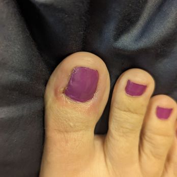 The White Spa Nails - I went there and right after my foot looked like this. I had a ton of pedicures before. My toe never looked like thsi - Nail Salons Near Me - Mesa, Arizona