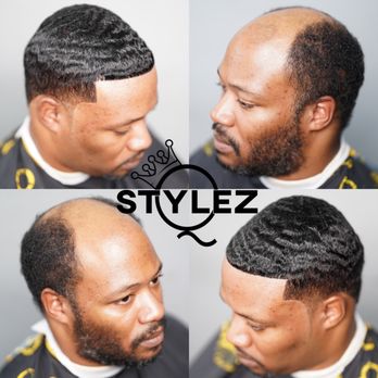 Hair Replacement Crown - Hair Extensions Near Me - Bronx, New York Hair Replacement Crown - Hair Extensions Near Me - Bronx, New York