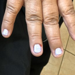 Cut caused by nail technician on Friday, March 6, 2020. special gel manicure. Cut caused by nail technician on Friday, March 6, 2020. special gel manicure.