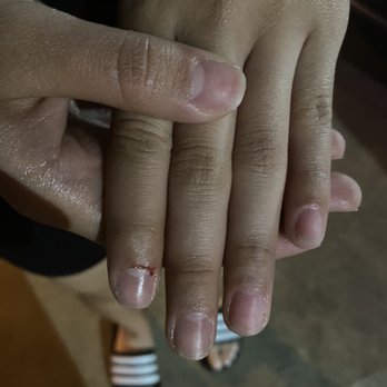 Sky Nail - They took them off and all her fingers were cut - Nail Salons Near Me - Alta Loma, California