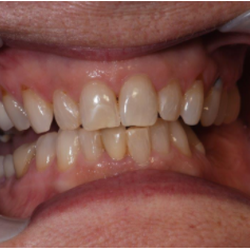 Jeffrey S Cummings, DMD - Before