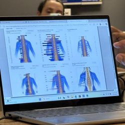 Torrey Hills Chiropractic - Evaluación de los nervios y donde tengo más tensión