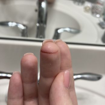 Venice Nail Bar - Finger injury - Nail Salons Near Me - Morrisville, North Carolina Venice Nail Bar - Finger injury - Nail Salons Near Me - Morrisville, North Carolina