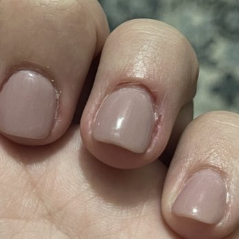 Elite Nails & Spa - She kept cutting away my cuticle numerous times on one finger and I kept bleeding. - Nail Salons Near Me - Odessa, Texas Elite Nails & Spa - She kept cutting away my cuticle numerous times on one finger and I kept bleeding. - Nail Salons Near Me - Odessa, Texas