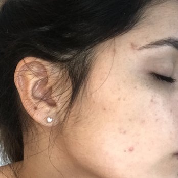 James Y. Wang, MD - Dermatologists Near Me - Los Angeles, California James Y. Wang, MD - Dermatologists Near Me - Los Angeles, California