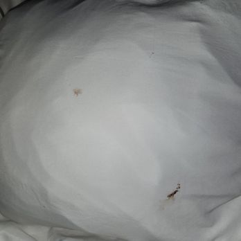 Comfort Suites - Blood stains. So nasty - Hotels Near Me - Bloomsburg, Pennsylvania Comfort Suites - Blood stains. So nasty - Hotels Near Me - Bloomsburg, Pennsylvania