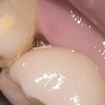 South Texas Endodontics - Endodontists Near Me - Corpus Christi, Texas South Texas Endodontics - Endodontists Near Me - Corpus Christi, Texas
