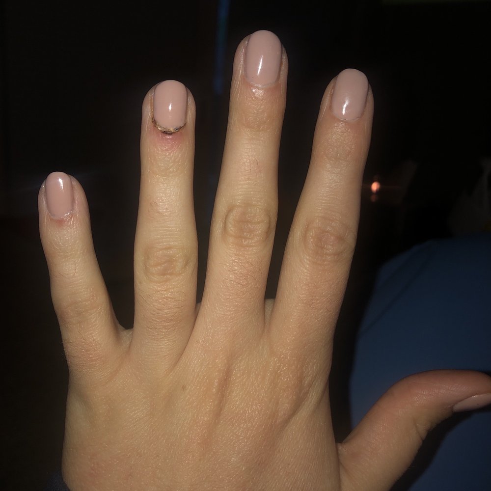 Poor manicure Poor manicure