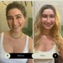 Hair Recovery Treatment Center