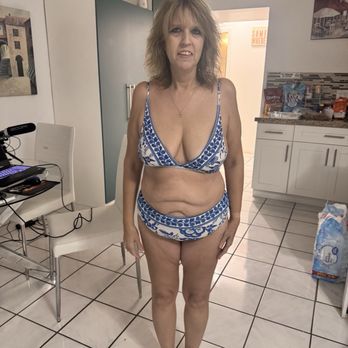 Fabio Castro, MD - My before surgery pic. - Cosmetic Surgeons Near Me - Aventura, Florida Fabio Castro, MD - My before surgery pic. - Cosmetic Surgeons Near Me - Aventura, Florida