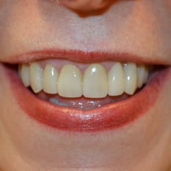 Heaton Dental