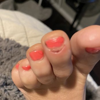 7 Day Spa & Nails - Nasty pedi cuticle slice. - Nail Salons Near Me - Tempe, Arizona 7 Day Spa & Nails - Nasty pedi cuticle slice. - Nail Salons Near Me - Tempe, Arizona