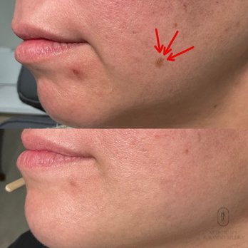 Bare Skin and Wax - Waxing Near Me - Trumbull, Connecticut