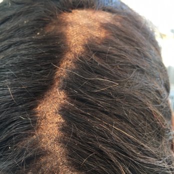 Miracles Hair Studio - This is after ONE week - Hair Extensions Near Me - Oakland, California