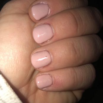 Great Nails - This is what Great Nails considers an IMPROVEMENT after doing a terrible SNS dip. This is gel polish put on SNS. Notice the cuticle cuts. - Nail Salons Near Me - Bastrop, Texas