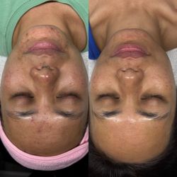 Skin By Britney