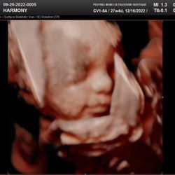 Peeping Moms Ultrasound Boutique