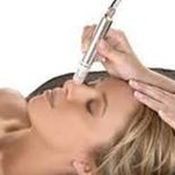 Microdermabrasion treatments